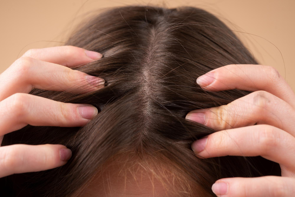 Tío o señor escaldadura Tóxico Remedios más eficaces para frenar la caída del cabello | E&J