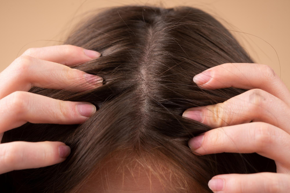 Sesión plenaria temerario sustantivo Remedios más eficaces para frenar la caída del cabello | E&J